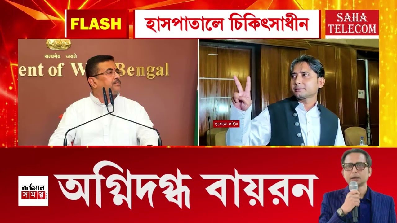 অ/গ্নিদ/গ্ধ বায়রন বিশ্বাস! অবস্থা গুরু/তর ?